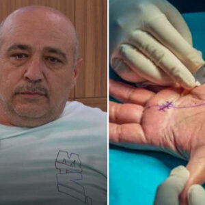 13 yillik bas agrisi kabusu 10 dakikada sona erdi Q4C6cQTY