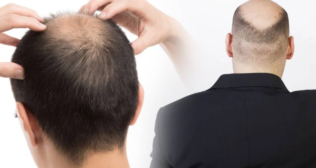 bu icecek kafada bir tel sac birakmiyor likir likir icenler yandi aSsl71HI