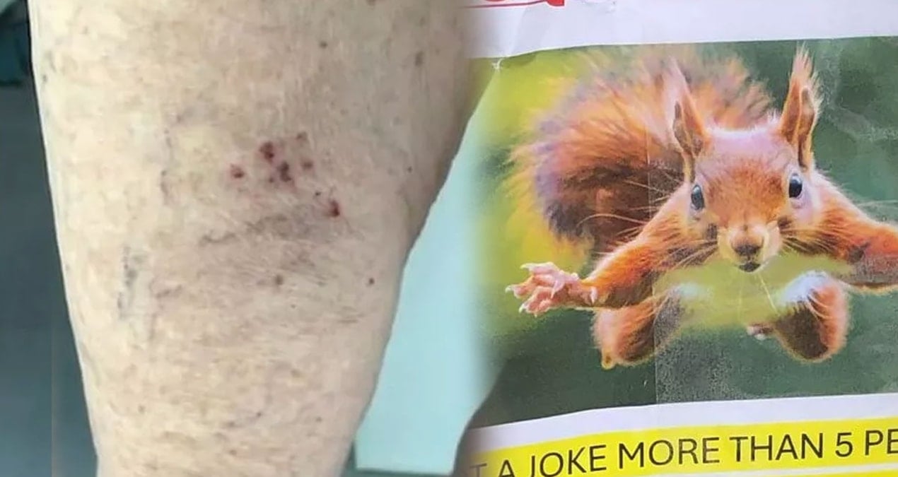 bir anda mahalleye dadandi kimse guvende degil herkes tedirgin FUszzbem